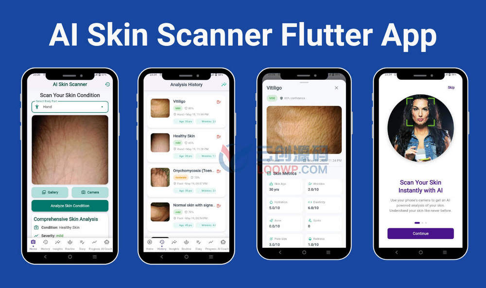 ChatGPT皮肤病检测器APP源码/AI皮肤诊断分析APP源码